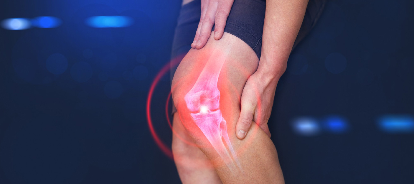 What is knee replacement surgery?